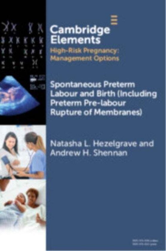 Spontaneous Preterm Labour and Birth (Including Preterm Pre-labour Rupture of Membranes) av Natasha L. (King's College London) Hezelgrave, Andrew
