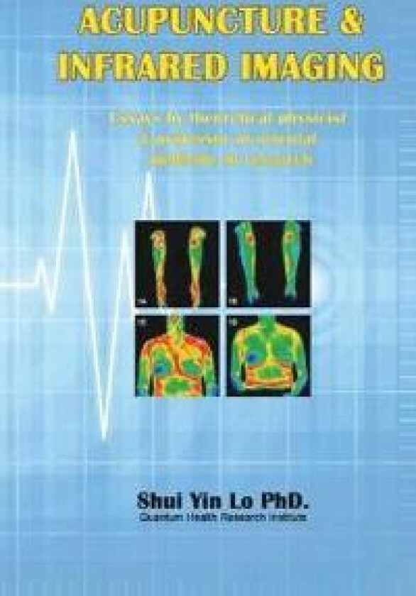 Acupuncture and Infrared Imaging