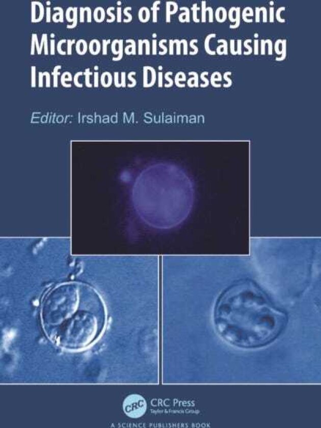 Diagnosis of Pathogenic Microorganisms Causing Infectious Diseases