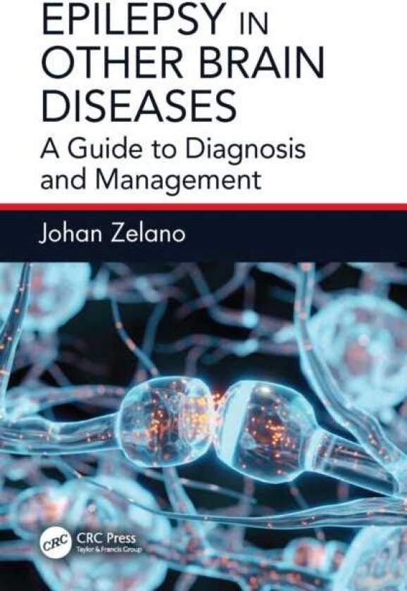 Epilepsy in Other Brain Diseases A Guide to Diagnosis and Management