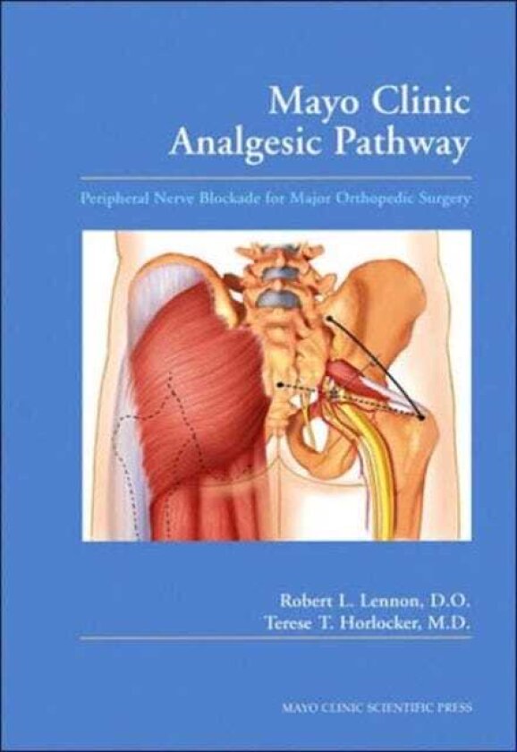 Mayo Clinic Analgesic Pathway Peripheral Nerve Blockade for Major Orthopedic Surgery