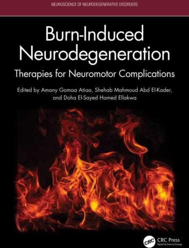 BurnInduced Neurodegeneration Therapies for Neuromotor Complications
