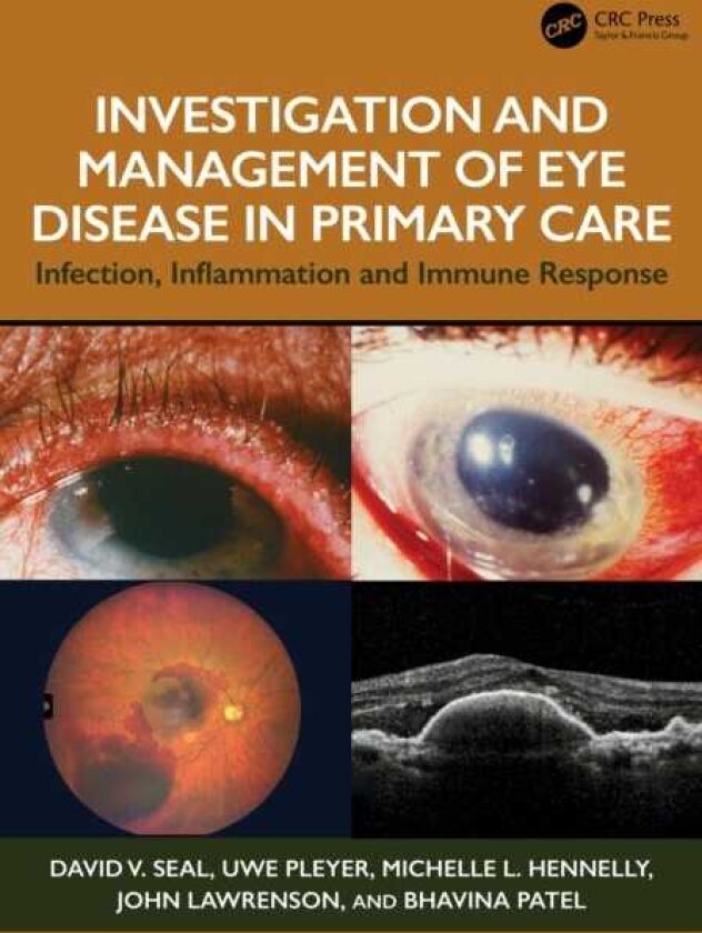 Investigation & Management of Eye Disease in Primary Care Infection, Inflammation and Immune Response