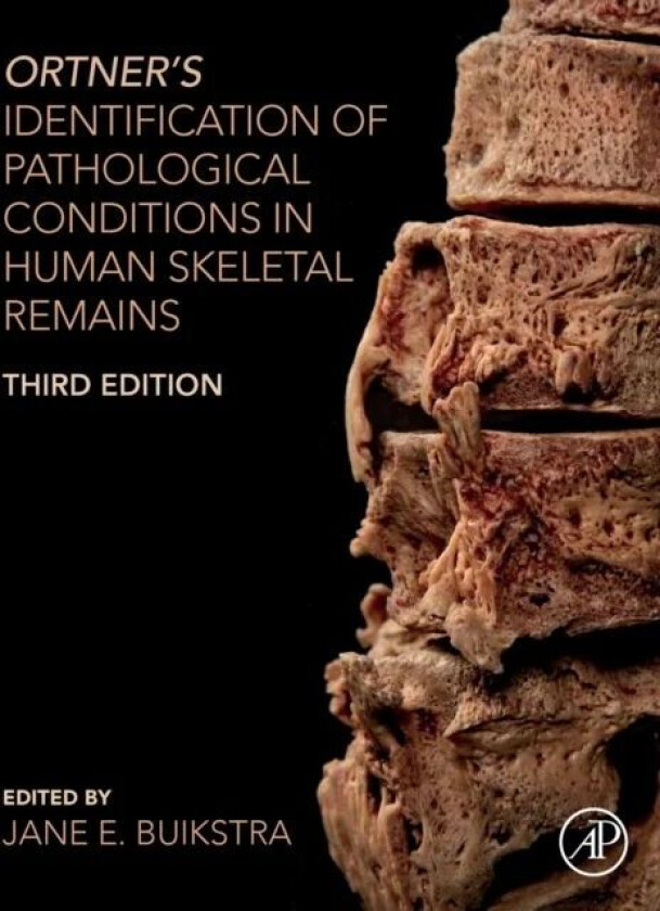 Bilde av Ortner's Identification of Pathological Conditions in Human Skeletal Remains