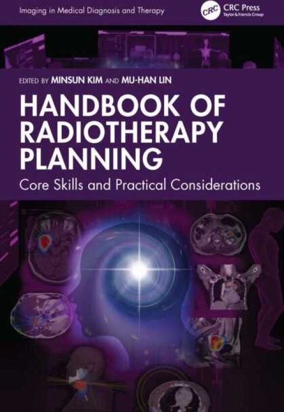 Handbook of Radiotherapy Planning Core Skills and Practical Considerations