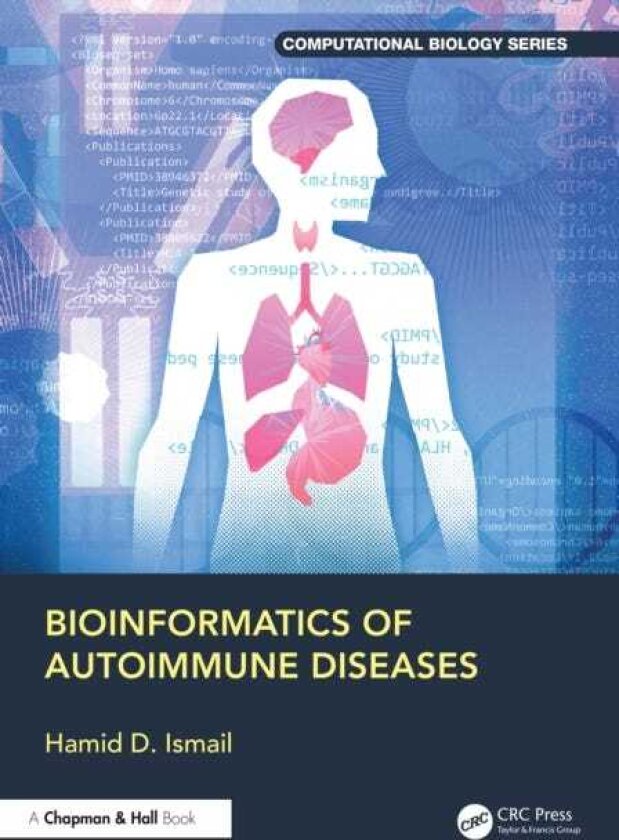Bioinformatics of Autoimmune Diseases