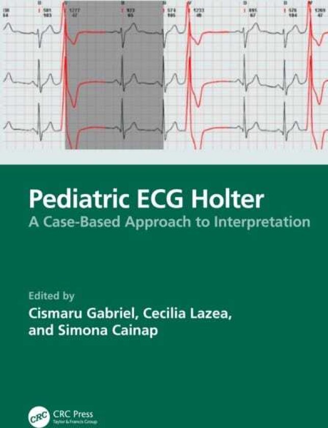 Pediatric ECG Holter A CaseBased Approach to Interpretation