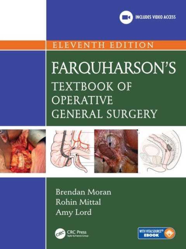 Bilde av Farquharson's Textbook of Operative General Surgery