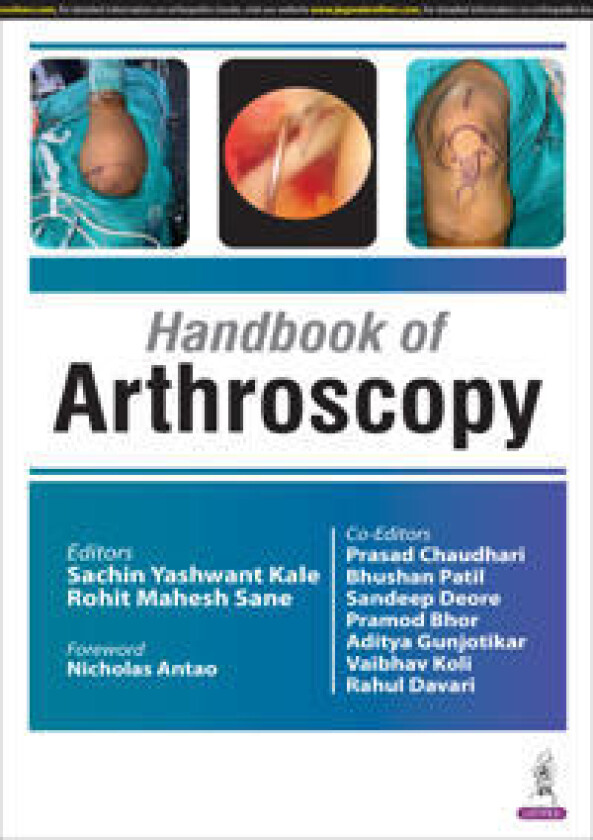 Handbook of Arthroscopy