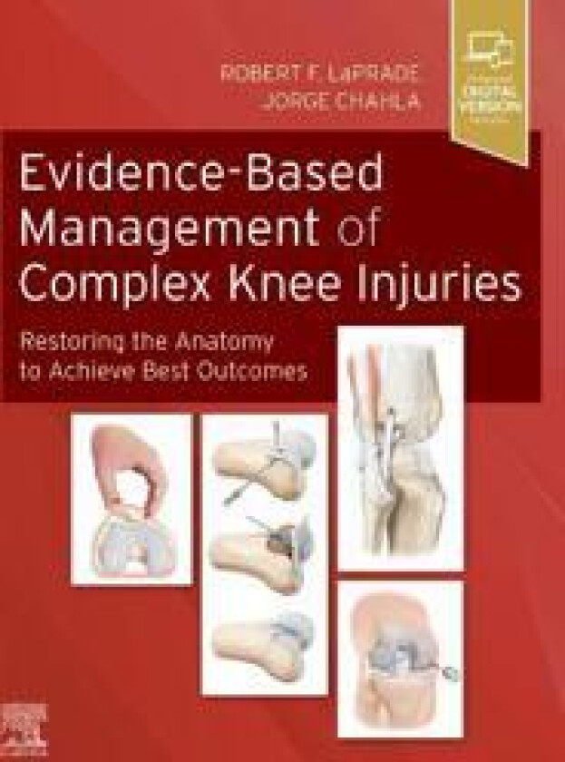 Evidence-Based Management of Complex Knee Injuries