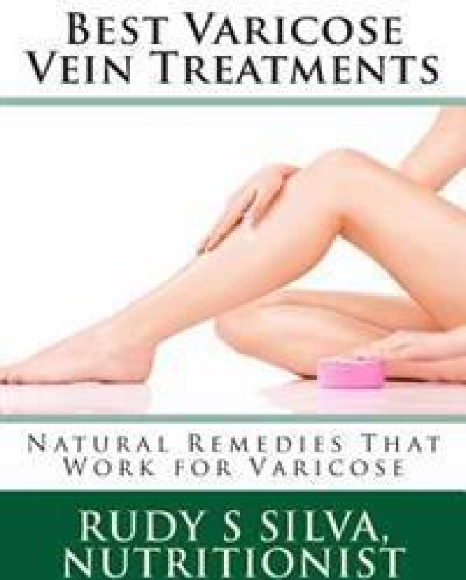 Best Varicose Vein Treatments: Natural Remedies That Work for Varicose