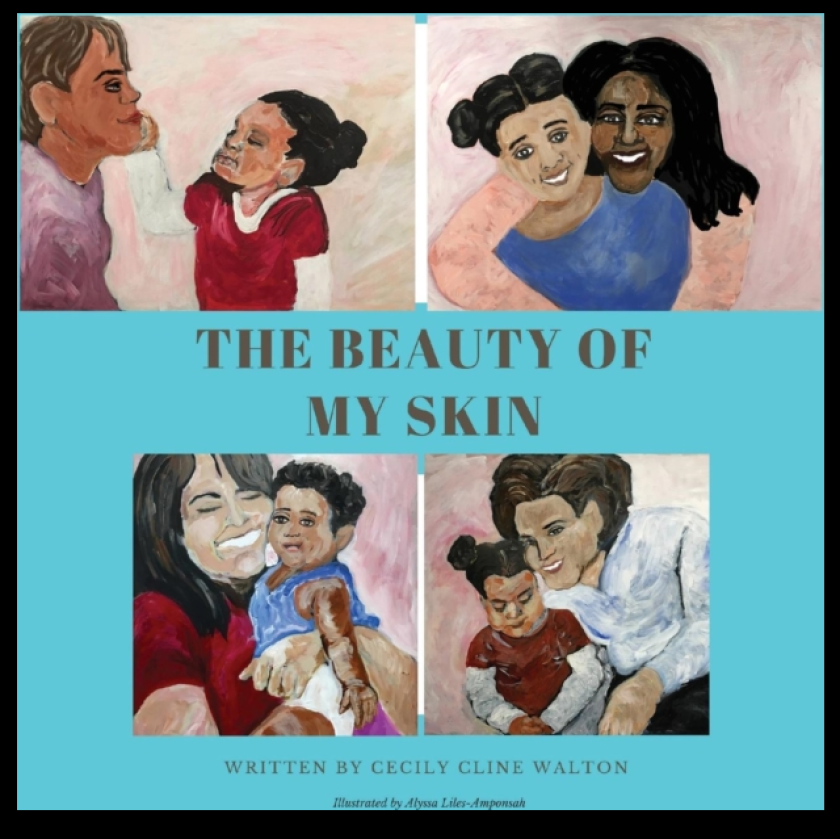 The Beauty of My Skin