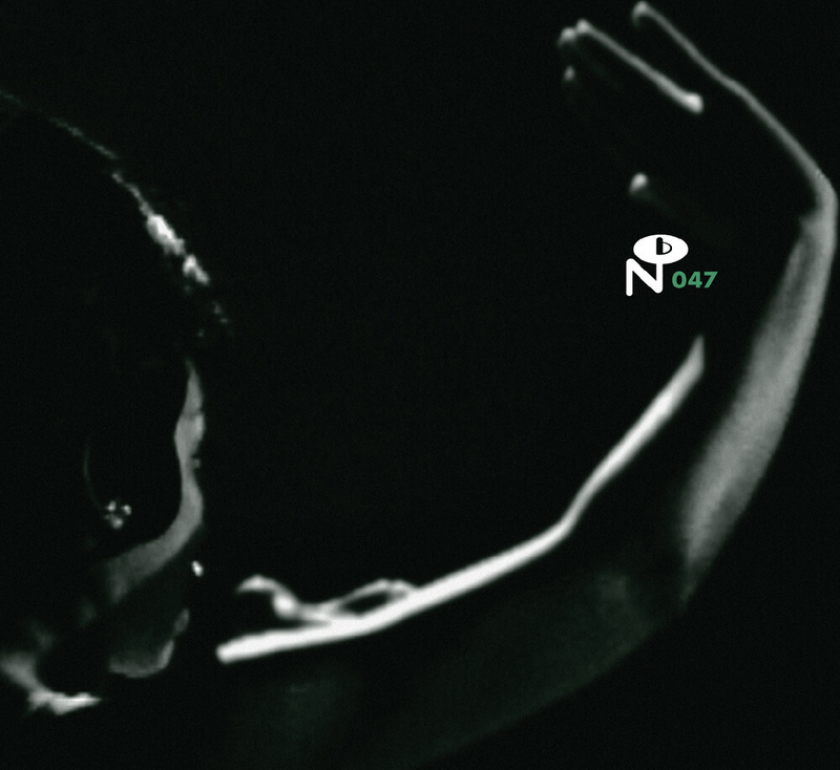 Diverse Artister Eccentric Soul: The Forte Label LP/Vinyl