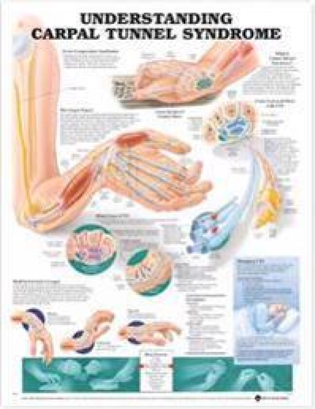 Understanding Carpal Tunnel Syndrome Anatomical Chart