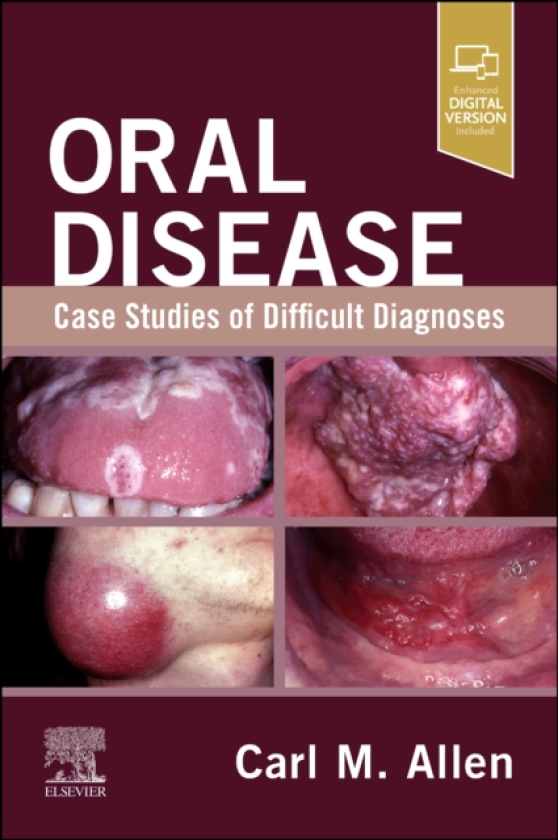 Oral Disease: Case Studies of Difficult Diagnoses Case Studies of Difficult Diagnoses