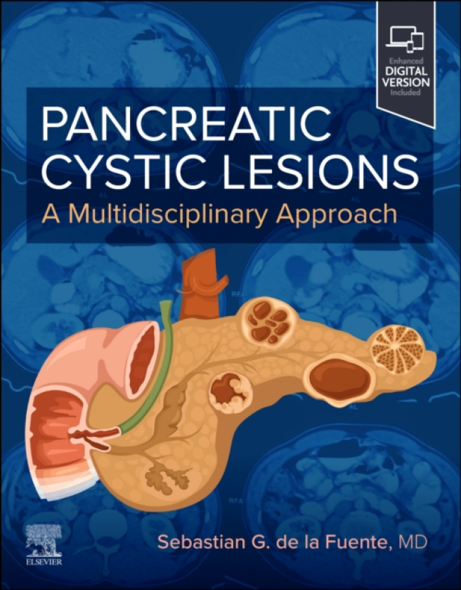 Pancreatic Cystic Lesions: A Multidisciplinary Approach A Multidisciplinary Approach