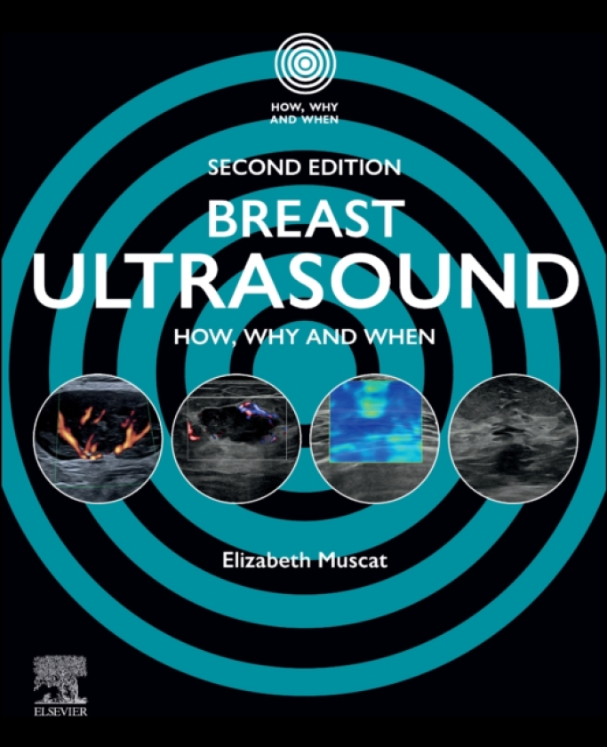 Breast Ultrasound How, Why and When